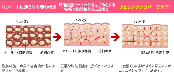 �C���X�g�F�c�F�����c�@�E�o�[�Œ蒅�I