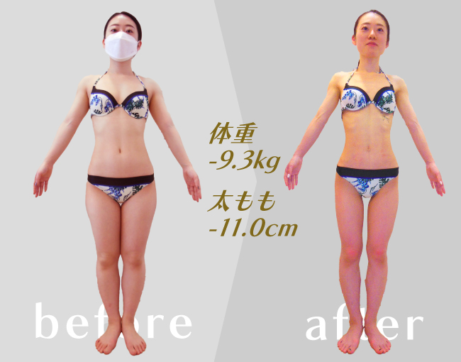 準グランプリ受賞者ビフォアアフター画像 体重-9.3kg,太もも-11cm