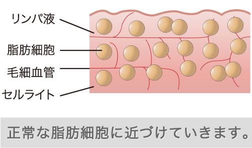 正常な脂肪細胞に戻していきます。