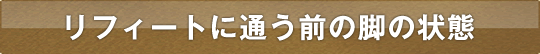 リフィートに通う前の脚の状態