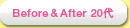 Before��After 20��